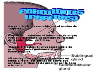 Paperas Inflamadas Parotiditis | PPT