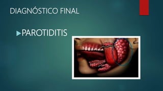 Parotiditis PPTX