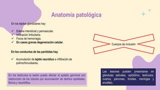 Anatomía patológica
En los tejidos glandulares hay:
 Edema intersticial y perivascular.
 Infiltración linfocitaria.
 Focos de hemorragia.
 En casos graves degeneración celular.
Cuerpos de inclusión
En los conductos de las parótidas hay:
 Acumulación de tejido necrótico e infiltración de
polimorfonucleares.
En los testículos la lesión puede afectar al epitelio germinal con
obstrucción de los túbulos por acumulación de detritus epiteliales,
fibrina y neutrófilos.
Las lesiones pueden presentarse en
glándulas salivales, epidídimo, testículos,
ovarios, páncreas, tiroides, meninges y
encéfalo.
 
