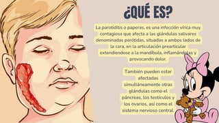 Paperas Inflamadas Comprehensive Overview of Parotiditis: Causes, Symptoms, and Prevention ...