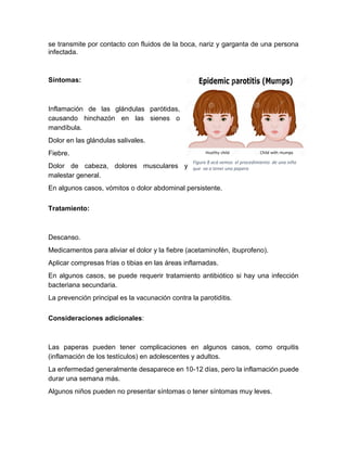 Paperas Inflamadas PAROTIDITIS PAPERA.pdf................................... | PDF