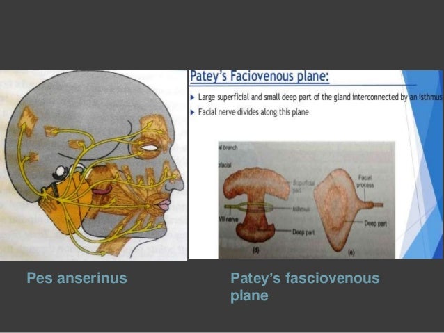 Parotid region and facial nerve