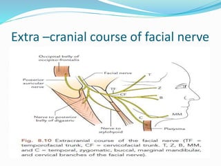 Extra –cranial course of facial nerve
 