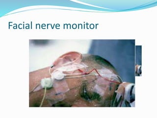 Facial nerve monitor
 