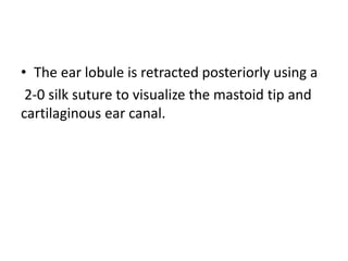 • The ear lobule is retracted posteriorly using a
2-0 silk suture to visualize the mastoid tip and
cartilaginous ear canal.
 