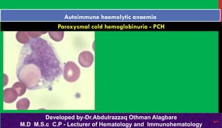 Paroxysmal cold hemoglobinuria - PCH
Autoimmune haemolytic anaemia
Developed by-Dr.Abdulrazzaq Othman Alagbare
M.D M.S.c C.P - Lecturer of Hematology and Immunohematology
1
 