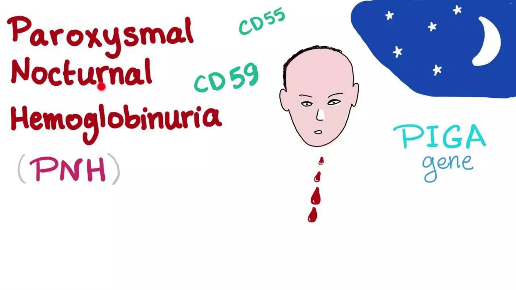 Paroxysmal nocternal hemoglobinuria | PPTX