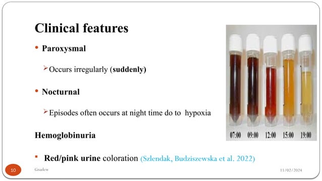 PAROXYSMAL NOCTURNAL HEMOGLOBINURIA.pptx