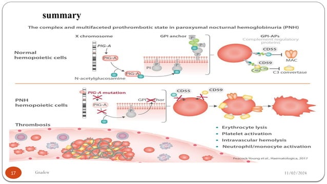 PAROXYSMAL NOCTURNAL HEMOGLOBINURIA.pptx