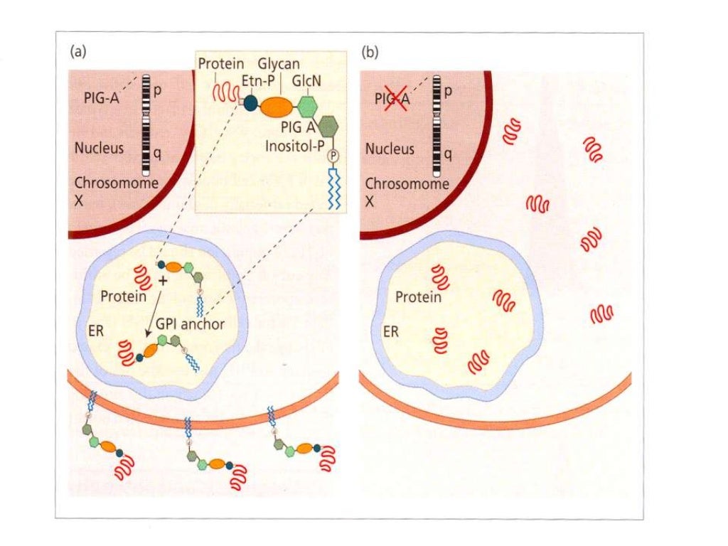 paroxysmal nocturnal hemoglobinuria statistics paroxysmal nocturnal hemoglobinuria statistics