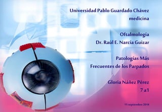 Universidad Pablo Guardado Chávez 
medicina 
Oftalmología 
Dr. Raúl E. Narcía Guizar 
Patologías Más 
Frecuentes de los Parpados 
Gloria Náñez Pérez 
7 a1 
11-septiembre-2014 
 