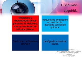 Distiquiasis 
adquirida 
Metaplasia y 
diferenciación de las 
glándulas de Meibomio, 
que se convierten en 
folículos pilosos. 
conjuntivitis cicatrizante 
en fase tardía, 
asociada con lesión 
química, 
Síndrome de Stevens- 
Johnson 
penfigoide cicatricial 
ocular. 
Oftalmología Clínica 
Jack J. Kanski, MD, MS, FRCS, FRCOphth 
and Brad Bowling, FRCSEd(Ophth), 
FRCOphth 
Elsevier Cap 1 pp 27 
 