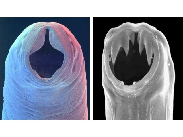 ANQUILOSTOMA DUODENAL PDF