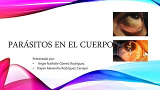PARÁSITOS EN EL CUERPO
Presentado por:
• Angie Nathalie Gómez Rodríguez
• Dayan Alexandra Rodríguez Carvajal
 