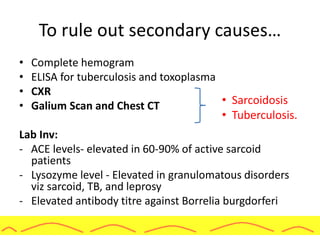 To rule out secondary causes…
• Complete hemogram
• ELISA for tuberculosis and toxoplasma
• CXR
• Galium Scan and Chest CT
Lab Inv:
- ACE levels- elevated in 60-90% of active sarcoid
patients
- Lysozyme level - Elevated in granulomatous disorders
viz sarcoid, TB, and leprosy
- Elevated antibody titre against Borrelia burgdorferi
• Sarcoidosis
• Tuberculosis.
 
