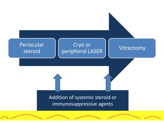 Addition of systemic steroid or
immunosuppressive agents
Periocular
steroid
Cryo or
peripheral LASER
Vitrectomy
 