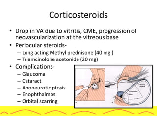 Corticosteroids
• Drop in VA due to vitritis, CME, progression of
neovascularization at the vitreous base
• Periocular steroids-
– Long acting Methyl prednisone (40 mg )
– Triamcinolone acetonide (20 mg)
• Complications-
– Glaucoma
– Cataract
– Aponeurotic ptosis
– Enophthalmos
– Orbital scarring
 