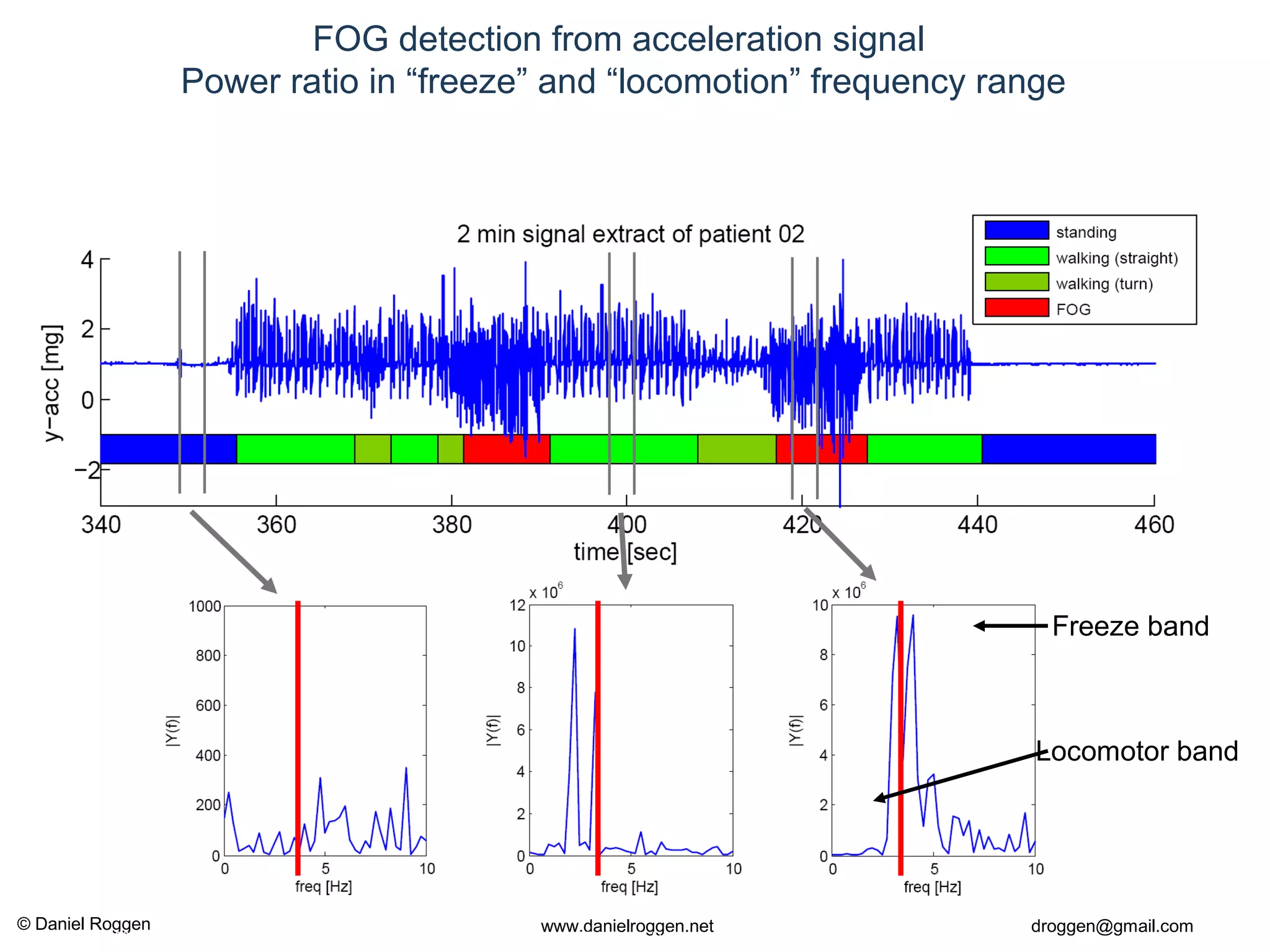 © Daniel Roggen www.danielroggen.net droggen@gmail.com
2nd
April 2009 41Daniel Roggen ETH Zürich / Wearable Computing Lab.
FOG detection from acceleration signal
Power ratio in “freeze” and “locomotion” frequency range
Freeze band
Locomotor band
 