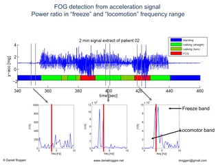 © Daniel Roggen www.danielroggen.net droggen@gmail.com
2nd
April 2009 41Daniel Roggen ETH Zürich / Wearable Computing Lab.
FOG detection from acceleration signal
Power ratio in “freeze” and “locomotion” frequency range
Freeze band
Locomotor band
 