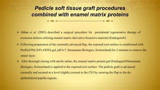 Pedicle soft tissue graft procedures
combined with enamel matrix proteins
 Abbas et al. (2003) described a surgical procedure for periodontal regenerative therapy of
recession defects utilizing enamel matrix derivative bioactive material (Emdogain®)
 Following preparation of the coronally advanced flap, the exposed root surface is conditioned with
PrefGelTM (24% EDTA-gel, pH 6.7; Straumann Biologics, Switzerland) for 2 minutes to remove the
smear layer.
 After thorough rinsing with sterile saline, the enamel matrix protein gel (Emdogain®Straumann
Biologics, Switzerland) is applied to the exposed root surface. The pedicle graft is advanced
coronally and secured at a level slightly coronal to the CEJ by suturing the flap to the de-
epithelialized papilla regions.
 