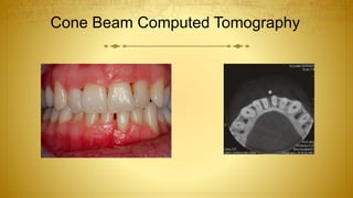 Cone Beam Computed Tomography
 