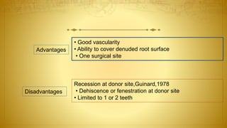 • Good vascularity
• Ability to cover denuded root surface
• One surgical site
Recession at donor site,Guinard,1978
• Dehiscence or fenestration at donor site
• Limited to 1 or 2 teeth
Advantages
Disadvantages
 