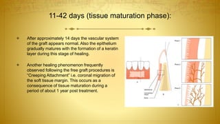 11-42 days (tissue maturation phase):
 After approximately 14 days the vascular system
of the graft appears normal. Also the epithelium
gradually matures with the formation of a keratin
layer during this stage of healing.
 Another healing phenomenon frequently
observed following the free graft procedures is
“Creeping Attachment” i.e. coronal migration of
the soft tissue margin. This occurs as a
consequence of tissue maturation during a
period of about 1 year post treatment.
 