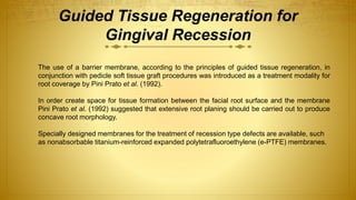 Guided Tissue Regeneration for
Gingival Recession
The use of a barrier membrane, according to the principles of guided tissue regeneration, in
conjunction with pedicle soft tissue graft procedures was introduced as a treatment modality for
root coverage by Pini Prato et al. (1992).
In order create space for tissue formation between the facial root surface and the membrane
Pini Prato et al. (1992) suggested that extensive root planing should be carried out to produce
concave root morphology.
Specially designed membranes for the treatment of recession type defects are available, such
as nonabsorbable titanium-reinforced expanded polytetrafluoroethylene (e-PTFE) membranes.
 