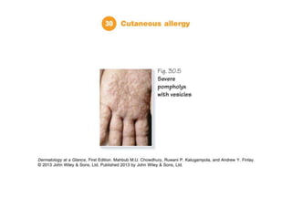 Part 10 skin allergy