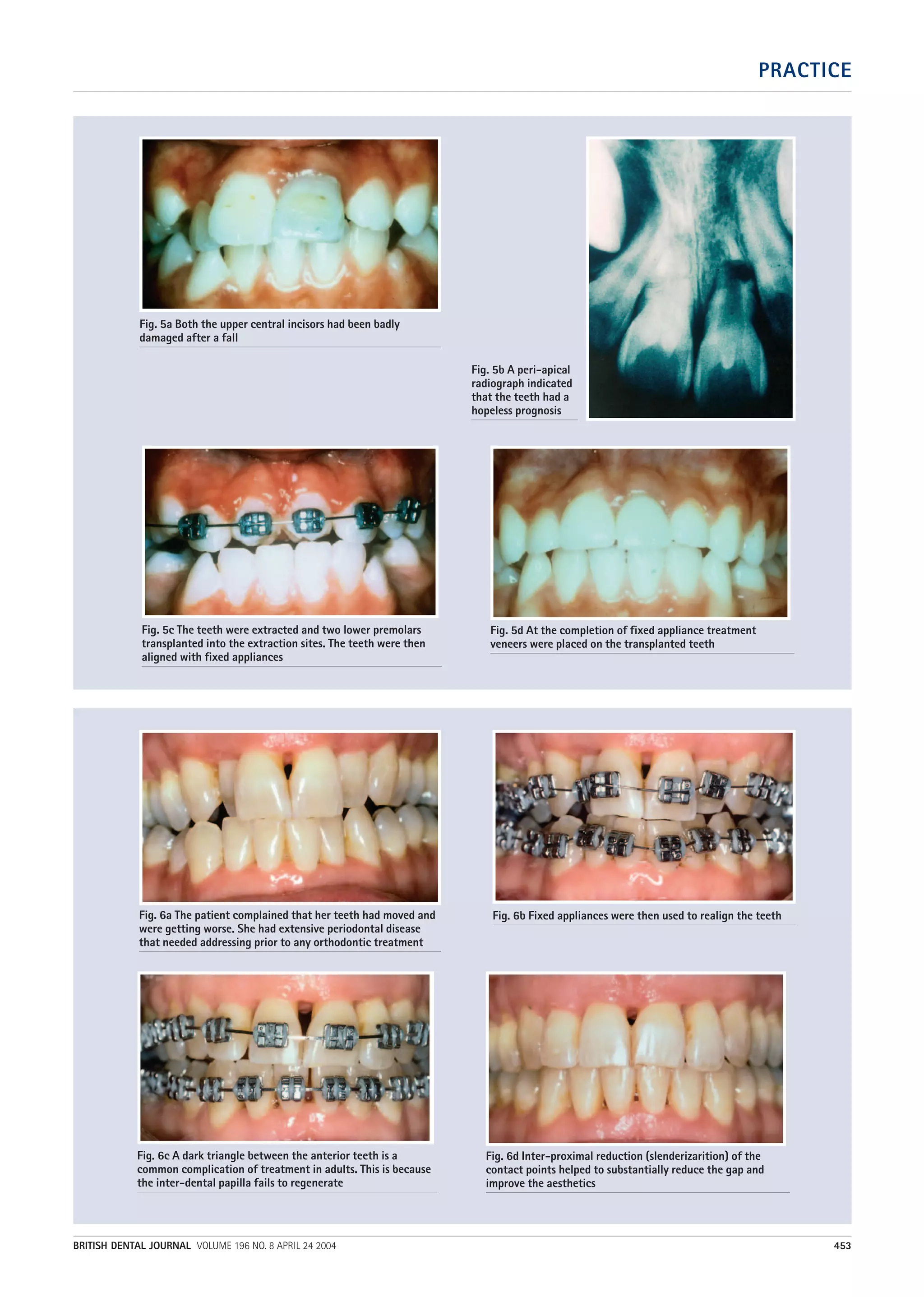 Part 12 combined orthodontic treatment | PDF