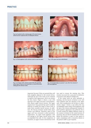 Part 12 combined orthodontic treatment | PDF