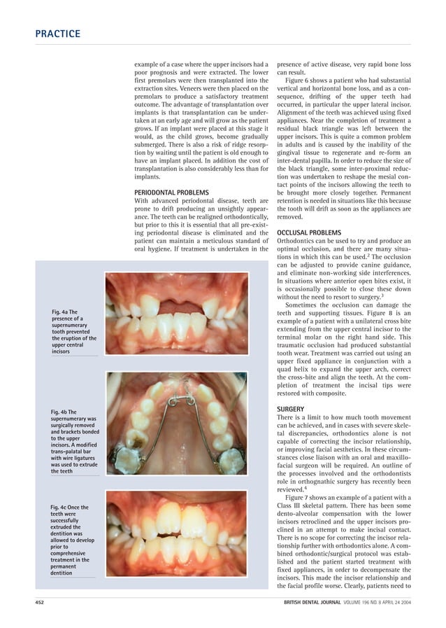 Part 12 combined orthodontic treatment | PDF