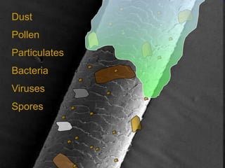 Dust
Pollen
Particulates
Bacteria
Viruses
Spores
 