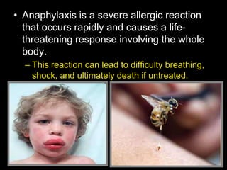 • Anaphylaxis is a severe allergic reaction
that occurs rapidly and causes a life-
threatening response involving the whole
body.
– This reaction can lead to difficulty breathing,
shock, and ultimately death if untreated.
 
