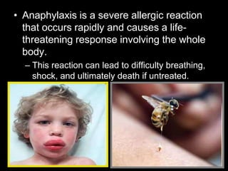 • Anaphylaxis is a severe allergic reaction
that occurs rapidly and causes a life-
threatening response involving the whole
body.
– This reaction can lead to difficulty breathing,
shock, and ultimately death if untreated.
 