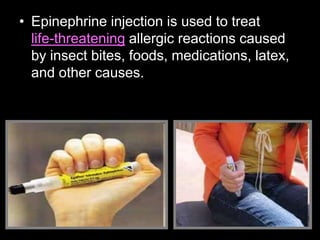 • Epinephrine injection is used to treat
life-threatening allergic reactions caused
by insect bites, foods, medications, latex,
and other causes.
 