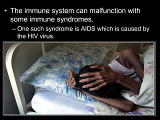 • The immune system can malfunction with
some immune syndromes.
– One such syndrome is AIDS which is caused by
the HIV virus.
 