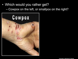 • Which would you rather get?
– Cowpox on the left, or smallpox on the right?
Copyright © 2010 Ryan P. Murphy
 