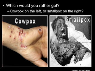 • Which would you rather get?
– Cowpox on the left, or smallpox on the right?
Copyright © 2010 Ryan P. Murphy
 