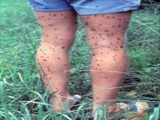 Immune System Lesson PowerPoint