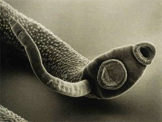 Immune System Lesson PowerPoint