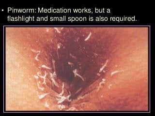 Immune System Lesson PowerPoint