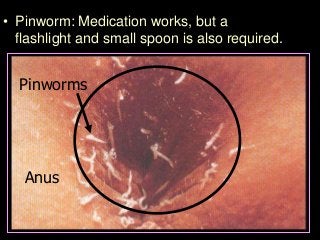 Immune System Lesson PowerPoint