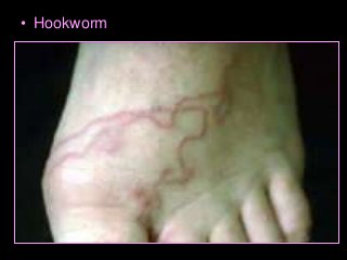 Immune System Lesson PowerPoint