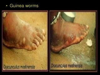 Immune System Lesson PowerPoint