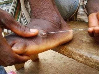 Immune System Lesson PowerPoint