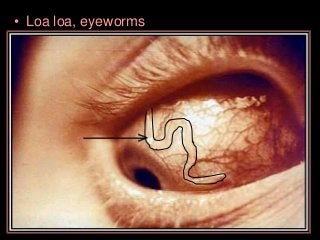 Immune System Lesson PowerPoint