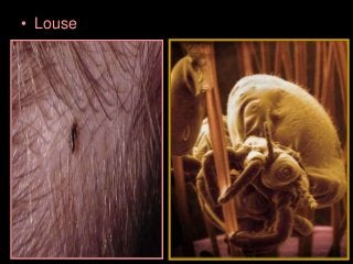 Immune System Lesson PowerPoint