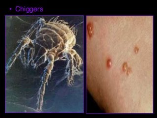 Immune System Lesson PowerPoint