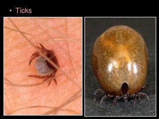 Immune System Lesson PowerPoint